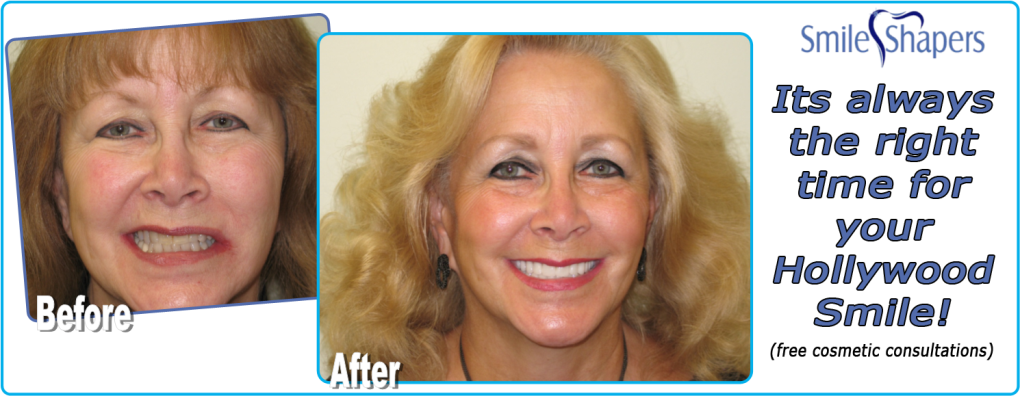 teeth whitening