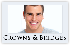 Crowns and Bridges Dental work