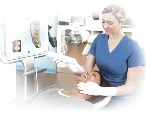 iTero Element scanner